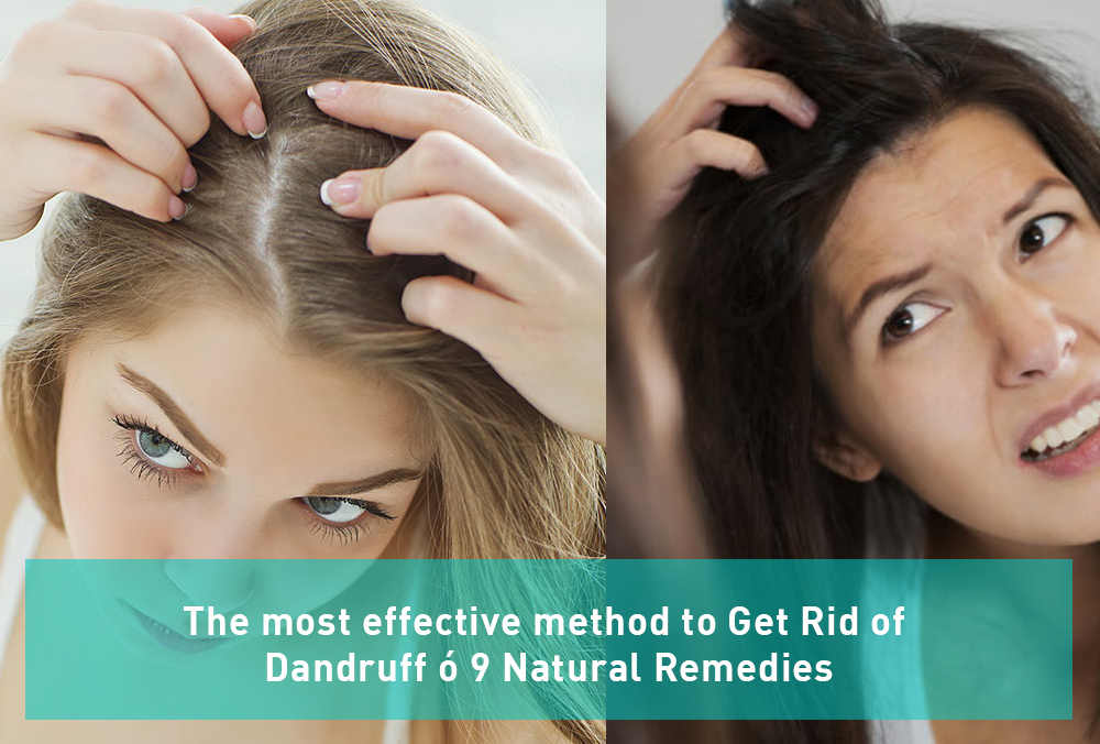 the most effective method to get rid of dandruff 9 natural remedies cokbilenler com